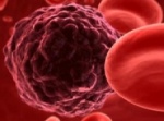 Влияние возраста отца с риском развития рака крови у ребенка