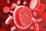 Влияние длительности хранения крови для переливания на исход заболевания пациента