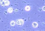 Микробиологические диагностические критерии бактериурии у беременных