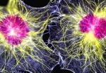 Выделены мышечные стволовые клетки человека