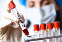 Полный перечень диагностических тестов для выявления коронавируса в России на 17 апреля