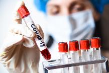 Полный перечень диагностических тестов для выявления коронавируса в России на 3 августа 