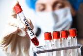 Полный перечень диагностических тестов для выявления коронавируса в России на 27 июля