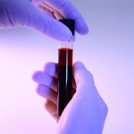 Новый метод выявления опасных патогенов в крови