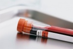 Анализ крови может стать альтернативой биопсии