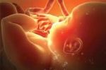 Британские ученые открыли ранее неизвестный независимый фактор риска внутриутробной смерти – пол плода.