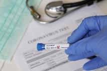 Полный перечень диагностических тестов для выявления коронавируса в России на 27 апреля