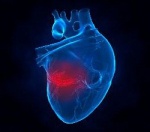 Прогностическая ценность Цистатина С, uNGAL и СКФ  у пациентов с подозрением на острый инфаркт миокарда