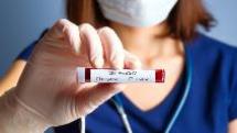 Полный перечень диагностических тестов для выявления коронавируса в России на 25 июня