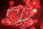 Опубликованы результаты первой фазы клинического исследования нового препарата для профилактики свертывания крови