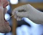 Изучение слюнных биомаркеров для ранней диагностики плоскоклеточного рака полости рта