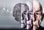 Недостаток витамина D связан с нарушением умственных способностей в старости