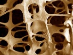 Оценено влияние курения и ХОБЛ на риск остеопороза у мужчин